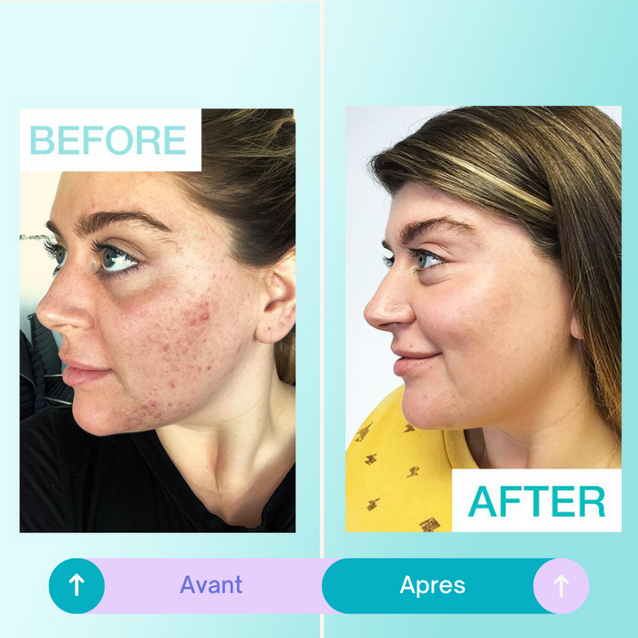 Proactiv+ Kit de traitement de l'acné  60 jours